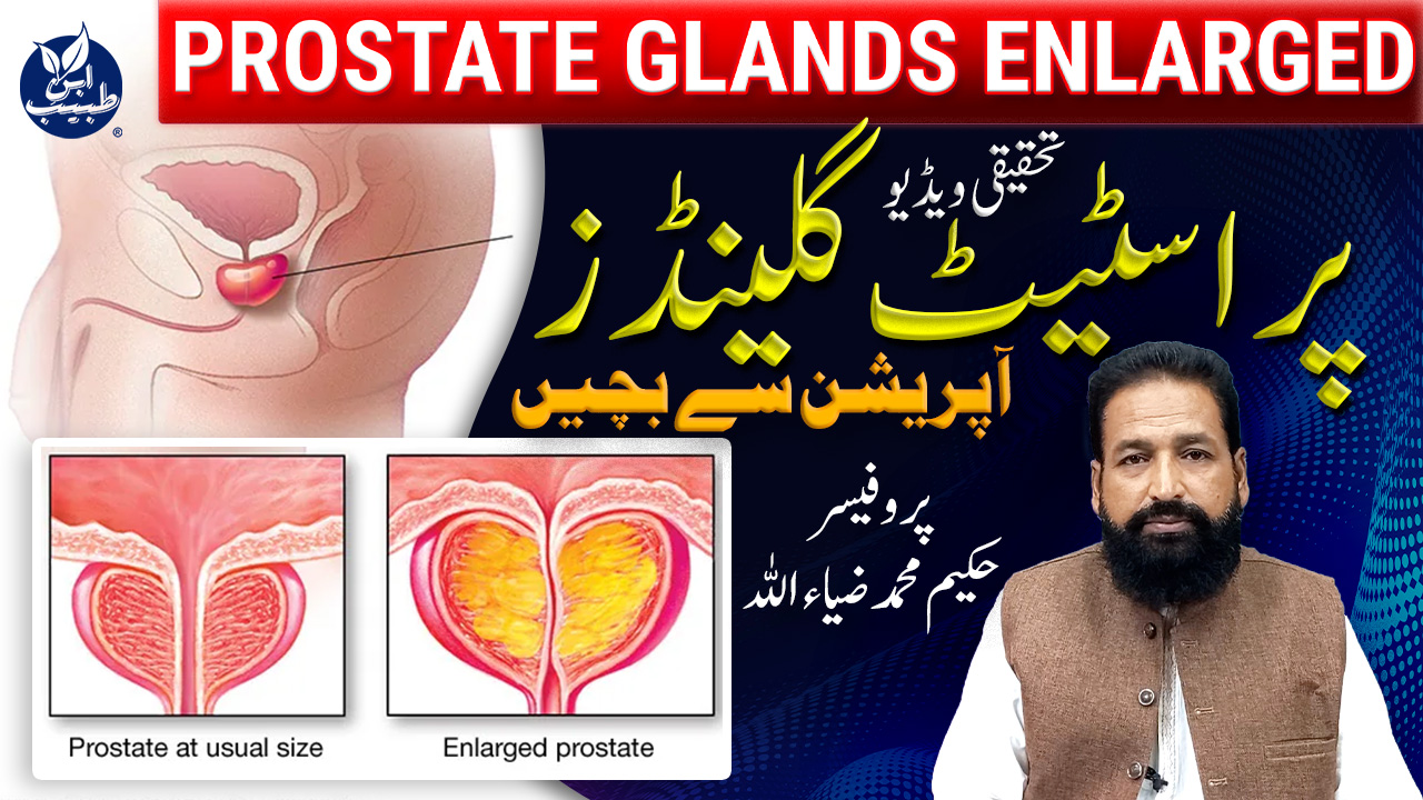 پروسٹیٹ گلینڈز