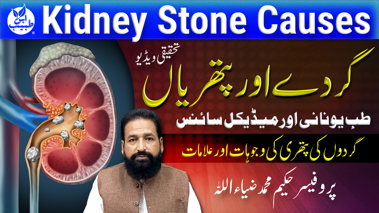 گردے اور پتھریاں